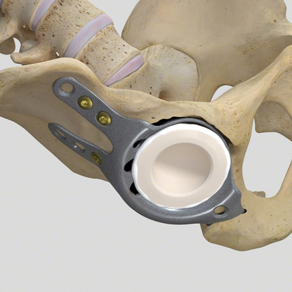 شل استابلوم